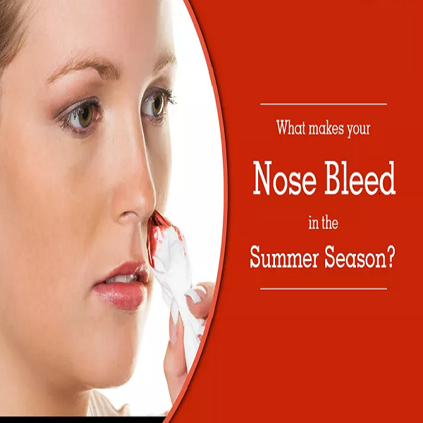 Why Do Nosebleeds Happen More Frequently in the Summer?